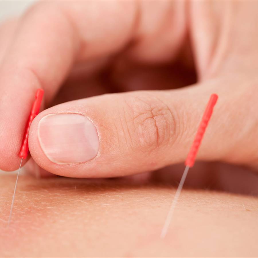 La acupuntura no es una pseudoterapia como dice el Gobierno