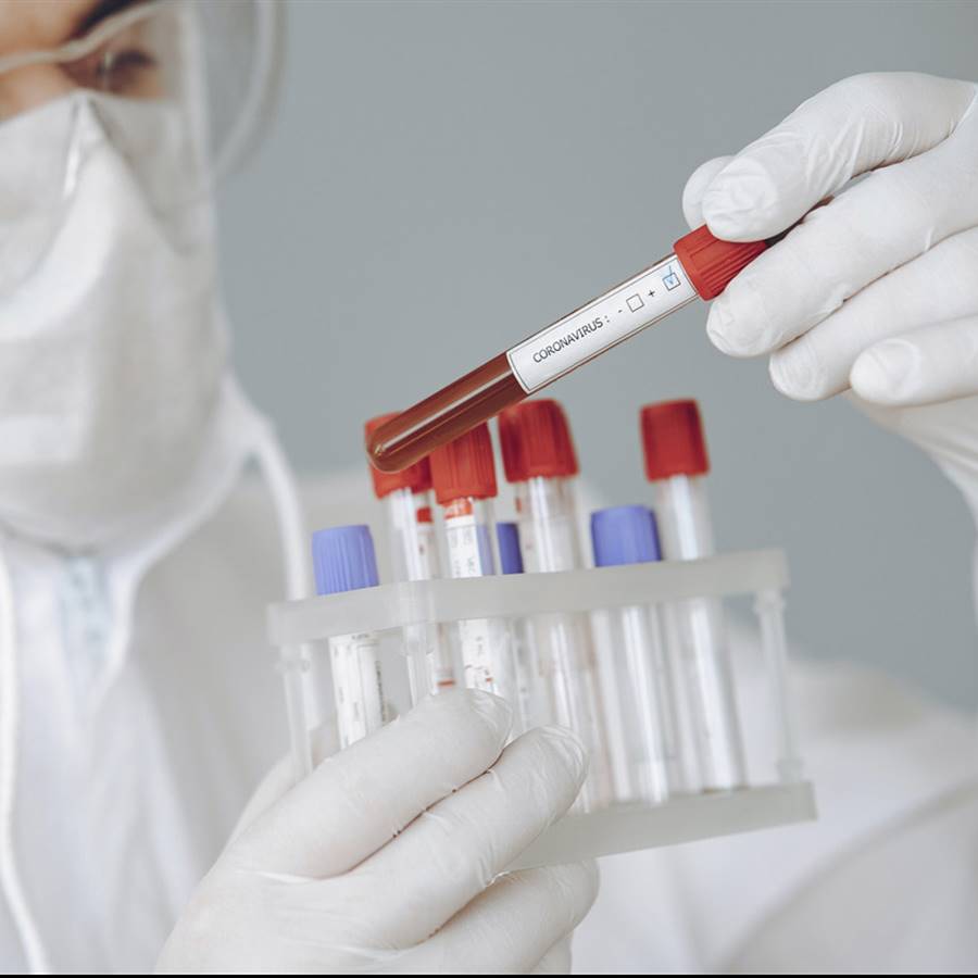 ¿Tiene sentido hacerse un test del coronavirus?