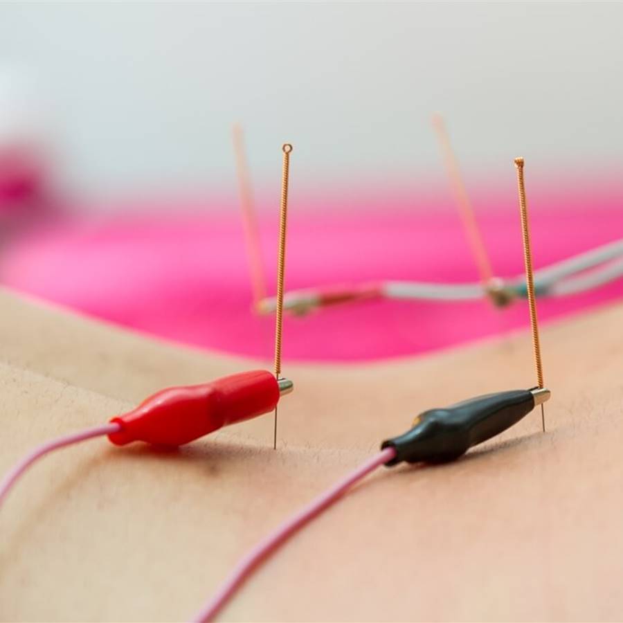 La electroacupuntura reduce la inflamación