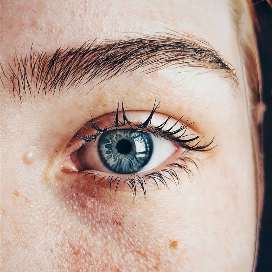 Ojo seco: tratamiento natural para calmar la irritación