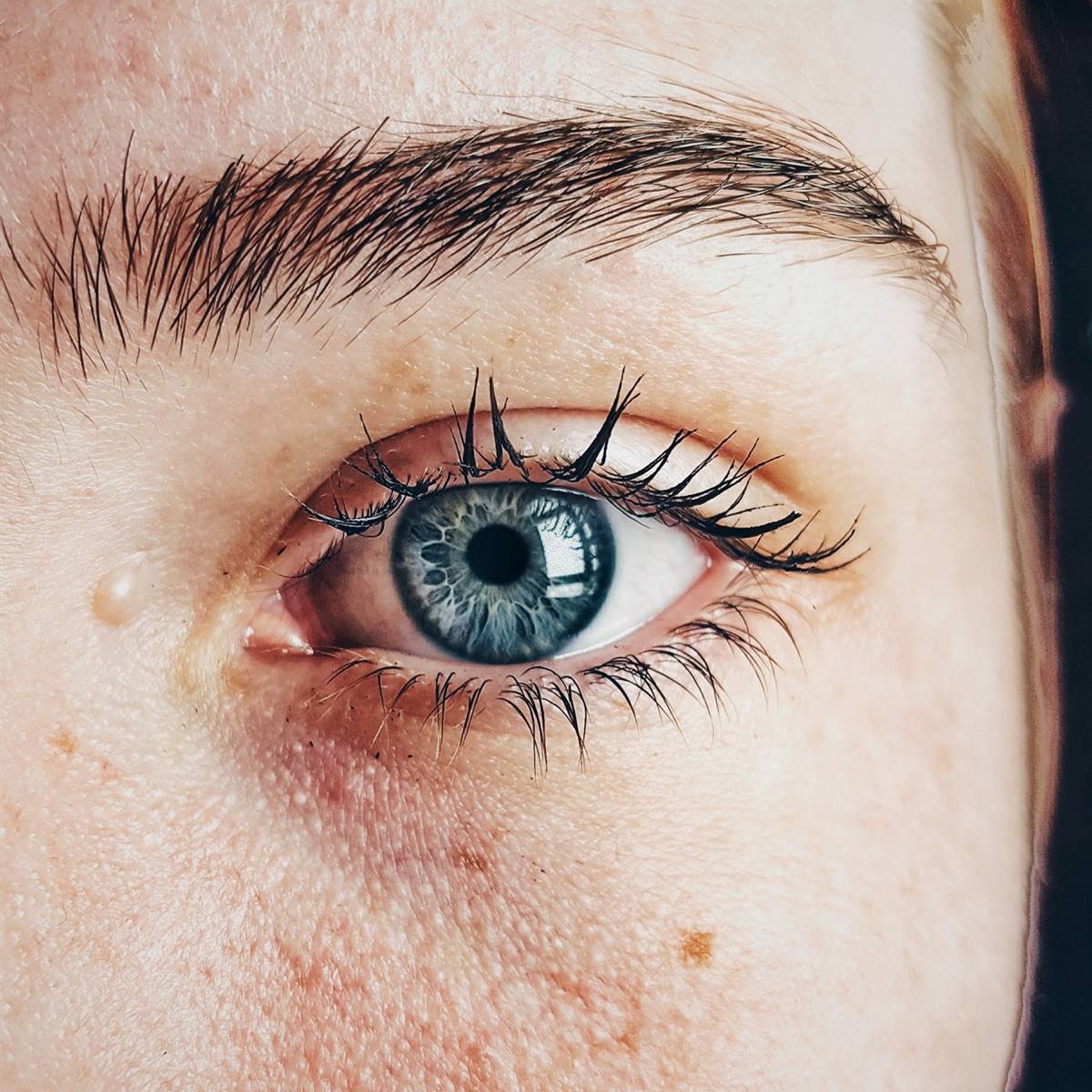 Ojo seco