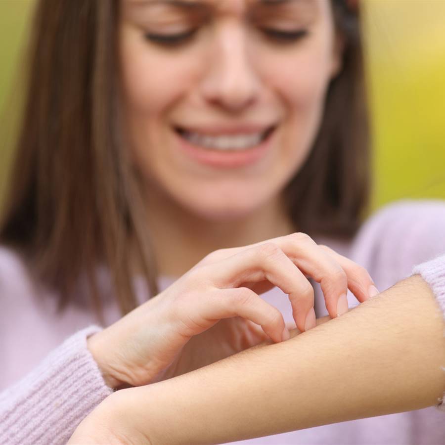 Picores en el cuerpo: posibles causas y soluciones naturales