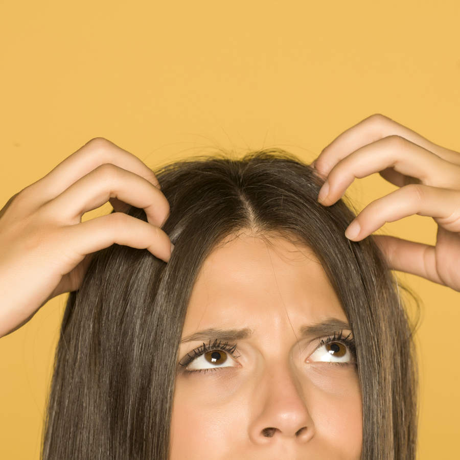 Cuero cabelludo seco: 4 remedios naturales