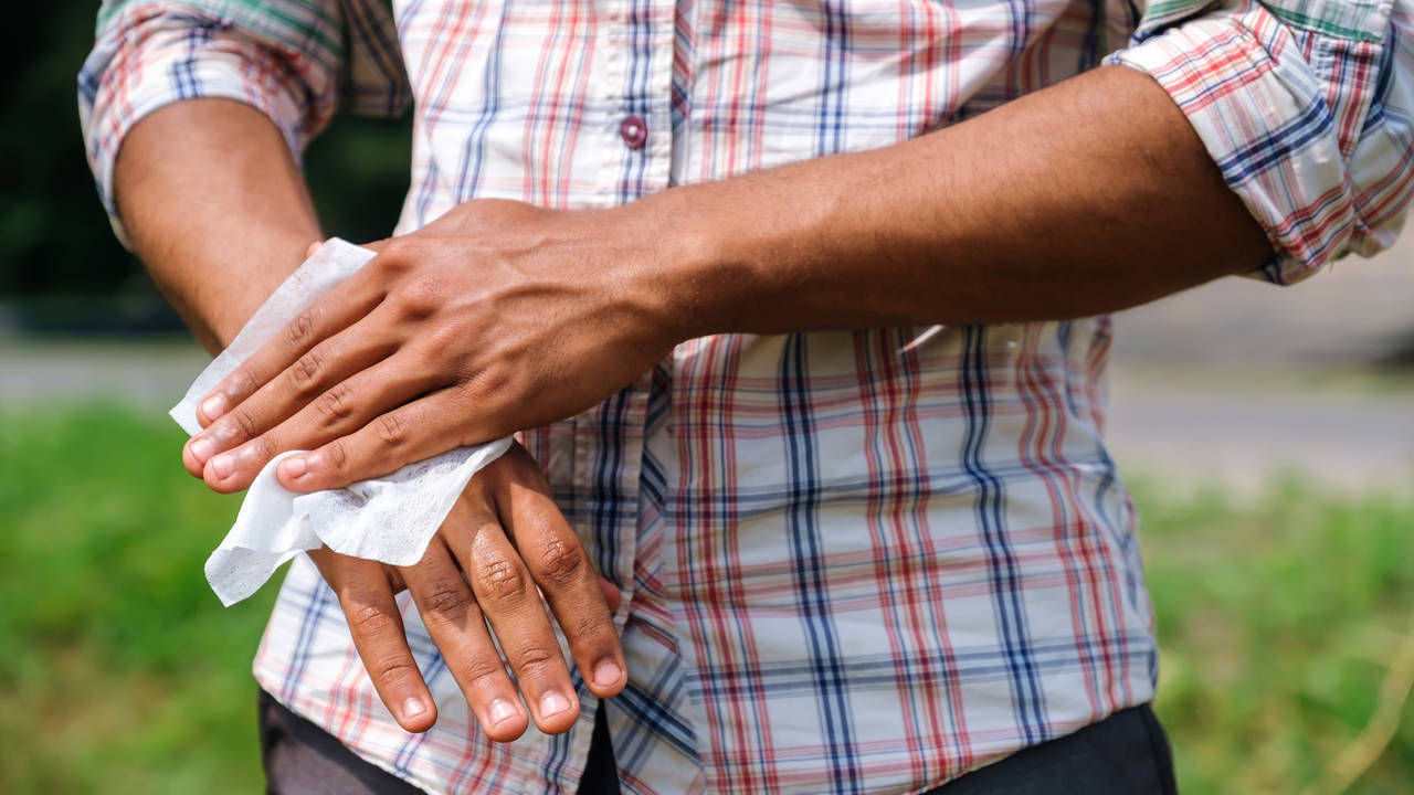 hiperidrosis palmar