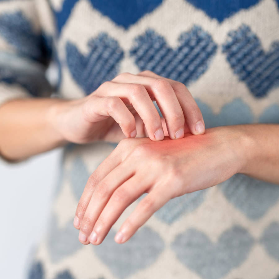 Dermatitis en las manos: causas y remedios caseros para aliviarla